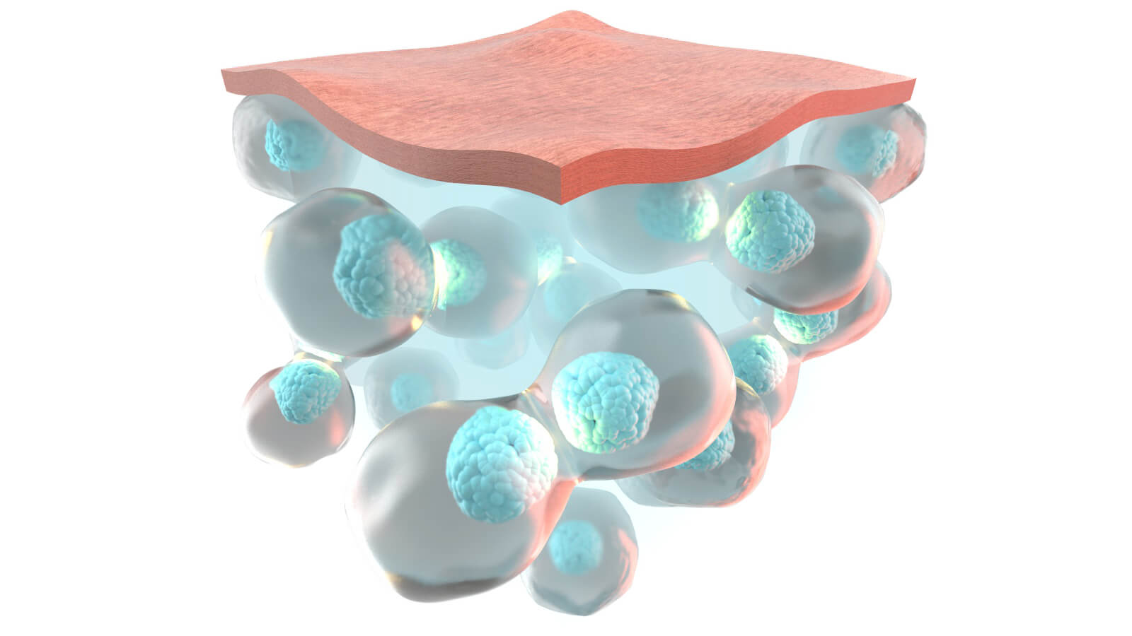 Rexonage3 - During QMR therapy