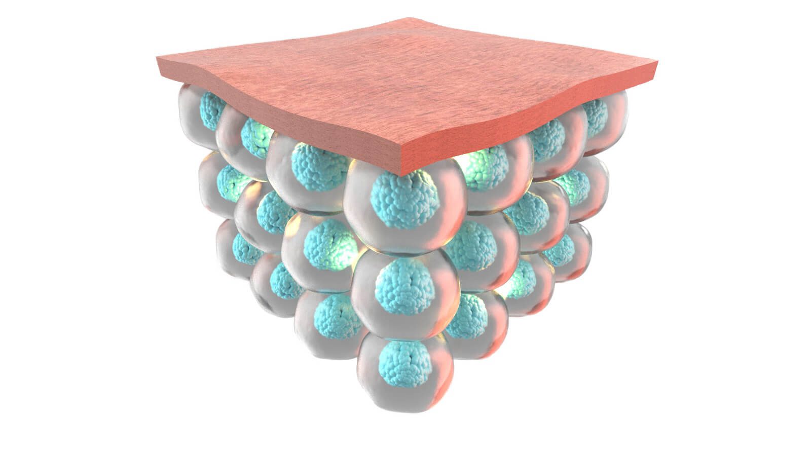 Rexonage3 - After QMR therapy